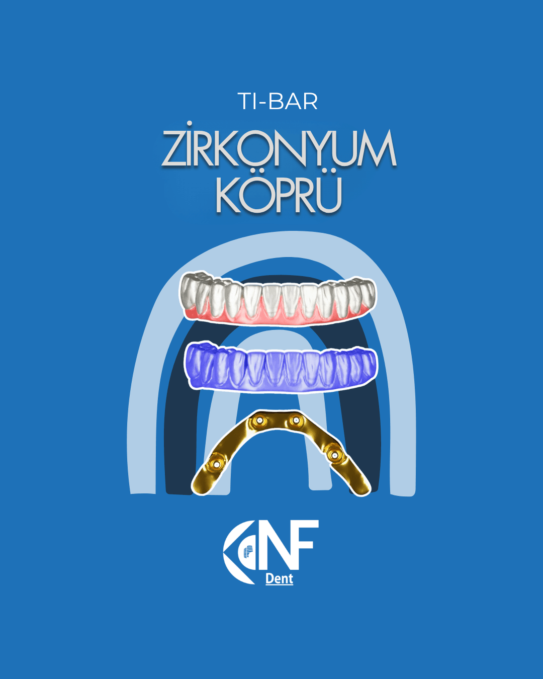 Nifa Dent