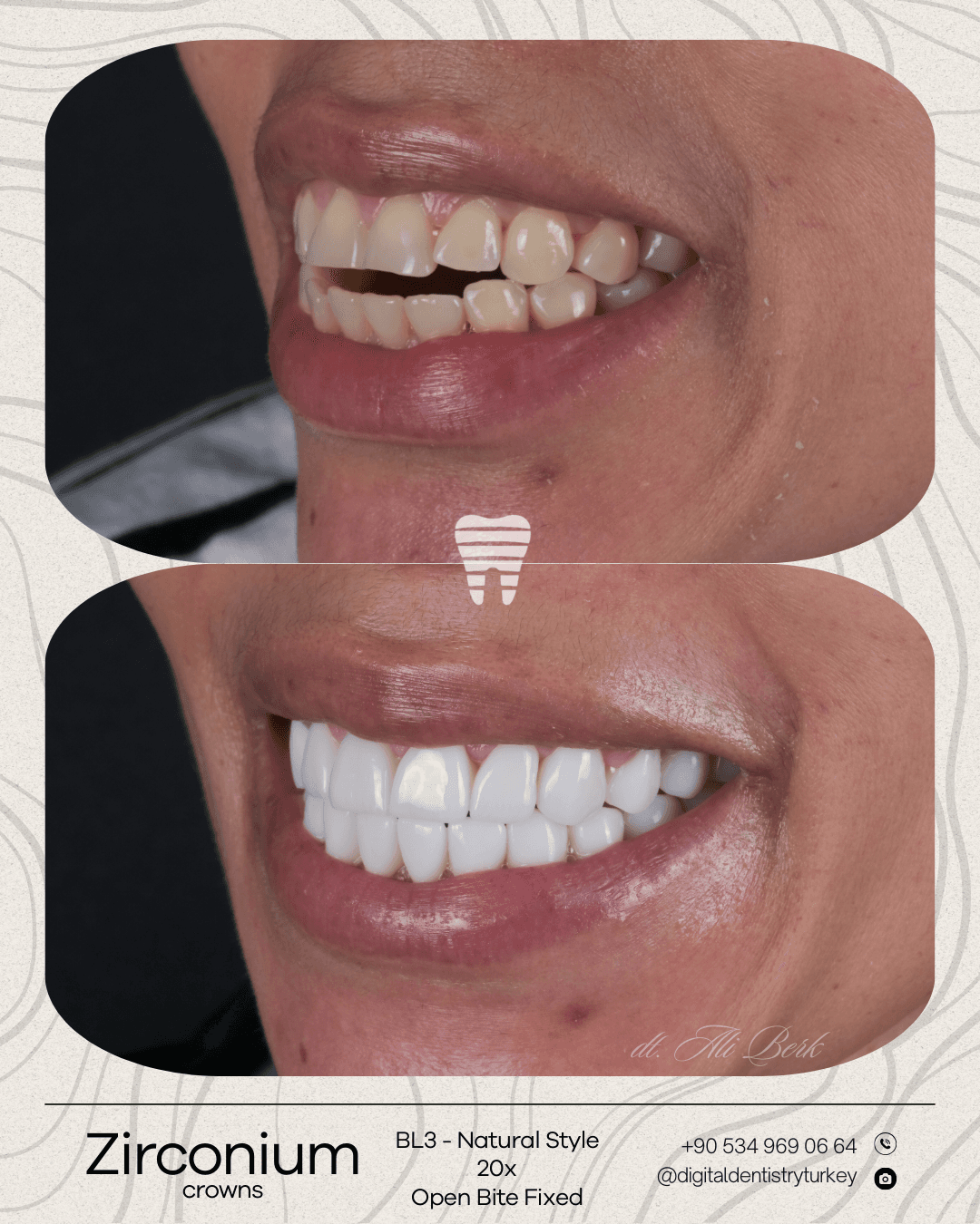 Digital Dentistry Turkey