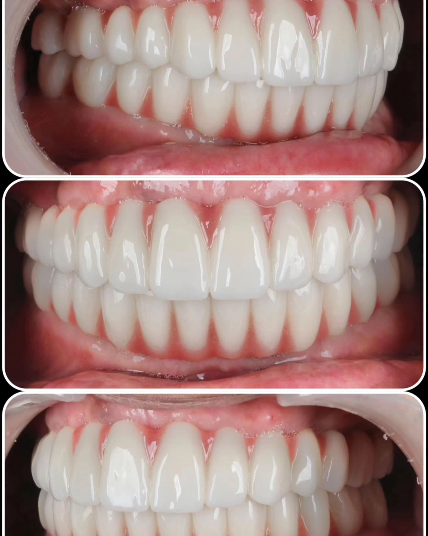 Hasta Memnuniyeti
